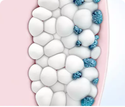 cellules graisseuses pouvant être traitées par la cryolipolyse de Coolsculpting après un second rendez-vous